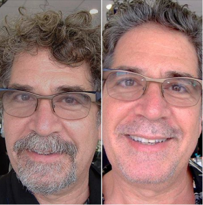 Side-by-side comparison of a man's face with a beard and glasses on the left, and clean-shaven with glasses on the right.